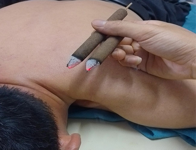 Đau cổ vai gáy do ngồi lái xe máy dưới trời mưa kéo dài