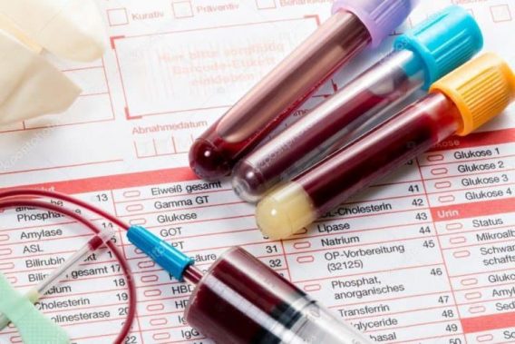 Công tác kiểm tra chất lượng xét nghiệm