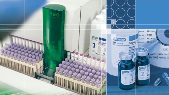 Những khái niệm cơ bản trong quản lý chất lượng xét nghiệm