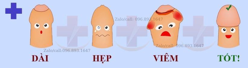 Bệnh lý bao quy đầu
