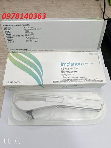 Que cấy tránh thai Implanon 6 que cay tt 01
