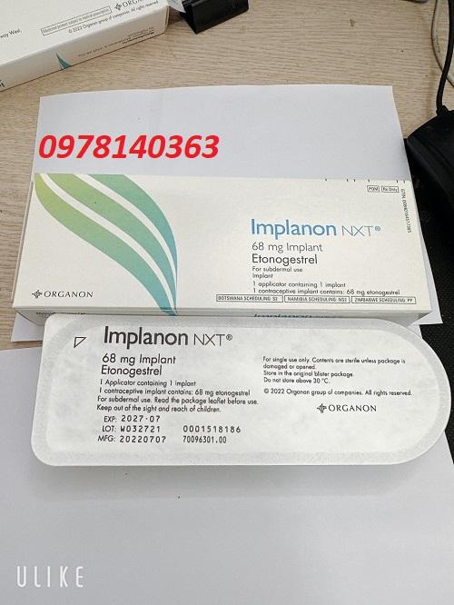 Que cấy tránh thai Implanon