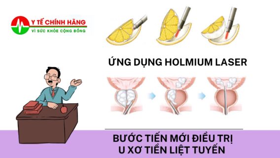 PHẪU THUẬT HOLEP U XƠ TIỀN LIỆT TUYẾN