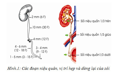 ytechinhhang-cac-doan-hep-cua-nieu-quan