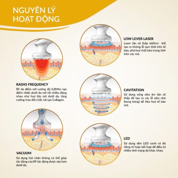 Công Nghệ Làm Đẹp Bằng Sóng RF 6 Công Nghệ Làm Đẹp Bằng Sóng RF