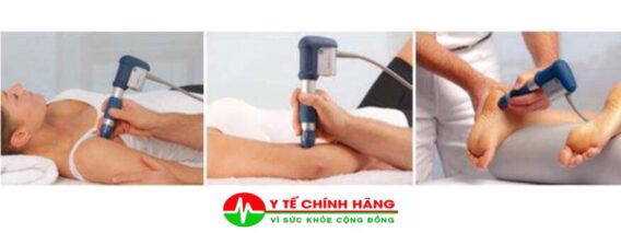 Điều Trị Viêm Khớp Bằng Sóng Xung Kích 3 Điều Trị Viêm Khớp Bằng Sóng Xung Kích