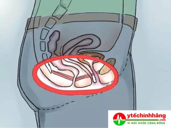 Cách Xác Định Cơ Sàn Chậu Tập Kegel 