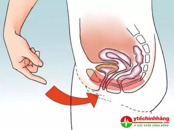 Cách Xác Định Cơ Sàn Chậu Tập Kegel