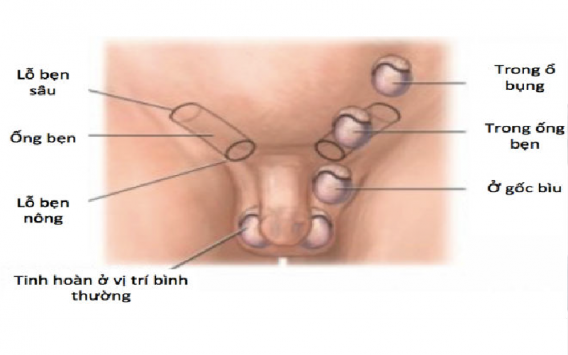Phương Pháp Cải Thiện Sinh Lý Nam Giới 14 da quy dau 56