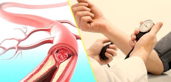 Phân Loại Tăng Huyết Áp Và Phân Tầng Nguy Cơ 8 Phân Loại Tăng Huyết Áp Và Phân Tầng Nguy Cơ