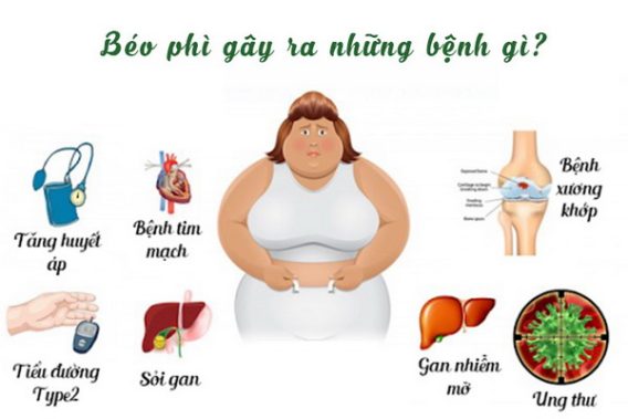 5 Nguy Cơ Của Bệnh Béo Phì