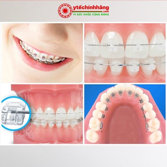 Dây Cung Thép Không Gỉ SS Vuông 16 Day Cung Vuong SS 12