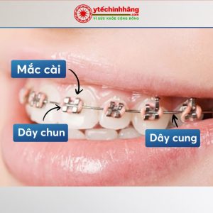 Dây Cung Thép Không Gỉ SS Vuông 10 Day Cung Vuong SS 14