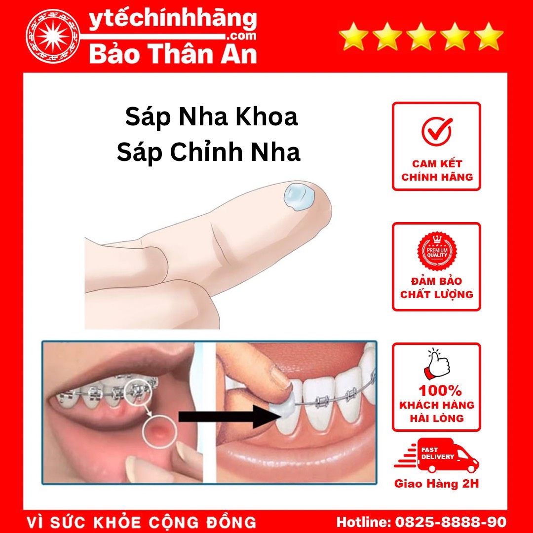 Sáp Nha Khoa 5 Sap Nha Khoa 5