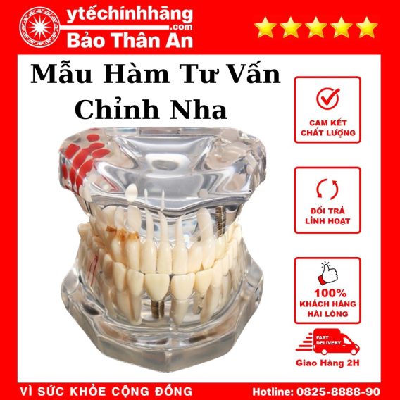 Mẫu Hàm Chỉnh Nha 8 Mau Ham Tu Van Chinh Nha