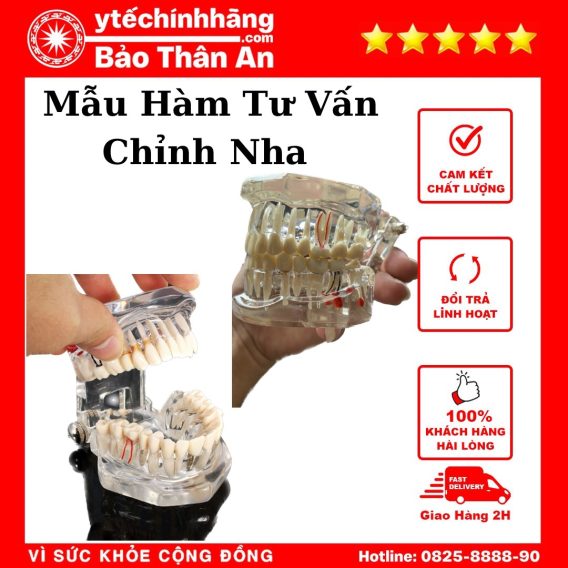 Mẫu Hàm Chỉnh Nha 9 Mau Ham Tu Van Chinh Nha