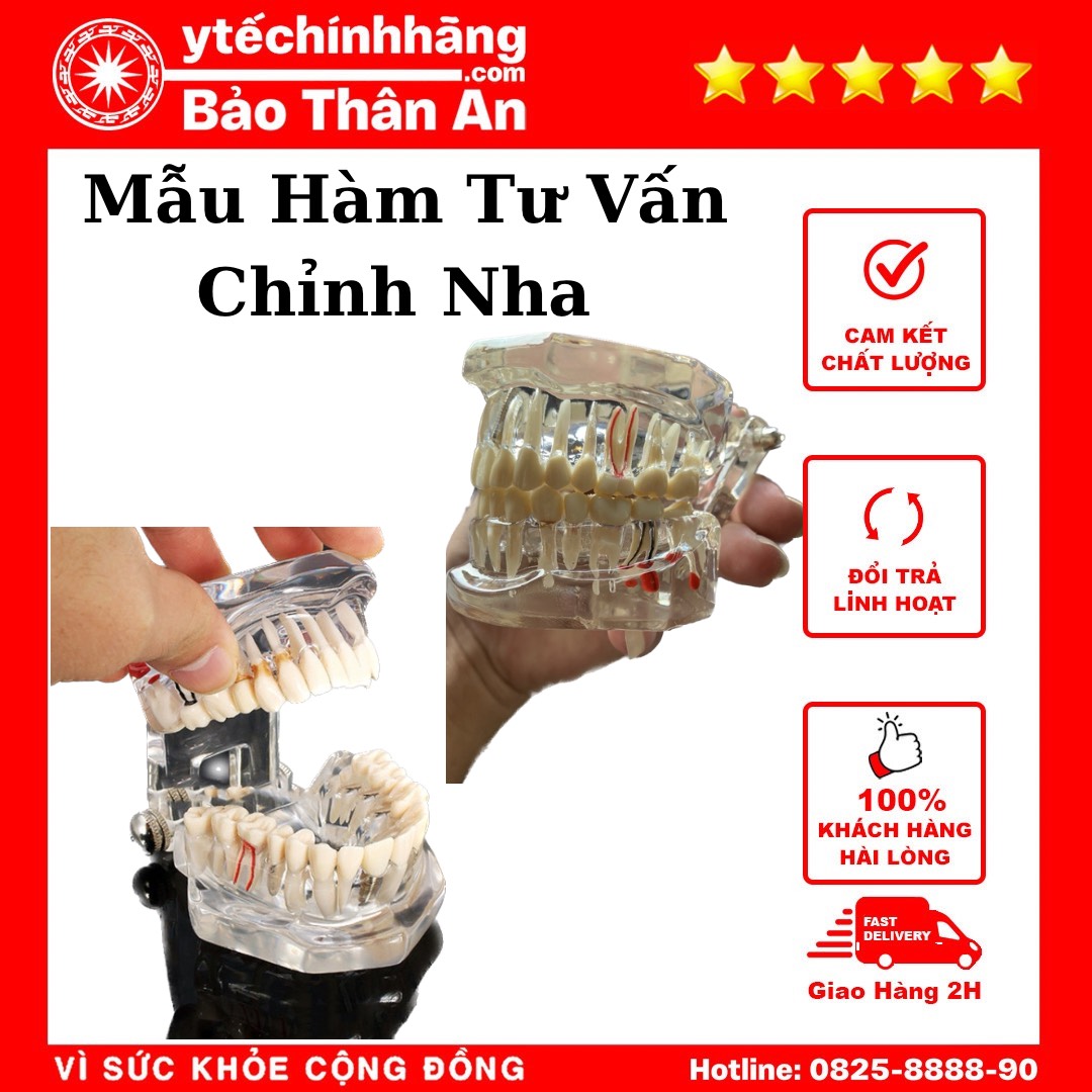 Mẫu Hàm Tư Vấn Chỉnh Nha Mau Ham Tu Van Chinh Nha