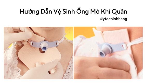 huong dan ve sinh ong mo khi quan