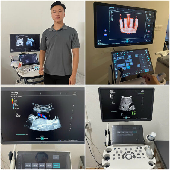 Máy siêu âm bàn đẩy Mindray Consona N6 13 giao may n6
