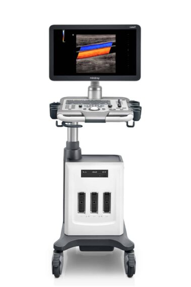 mindray dc30 ultrasound machine