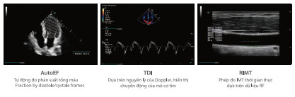 Máy siêu âm bàn đẩy Mindray Consona N6 12 z4794864404408 6d13b0d77c21ad6bced697ceaef35a52