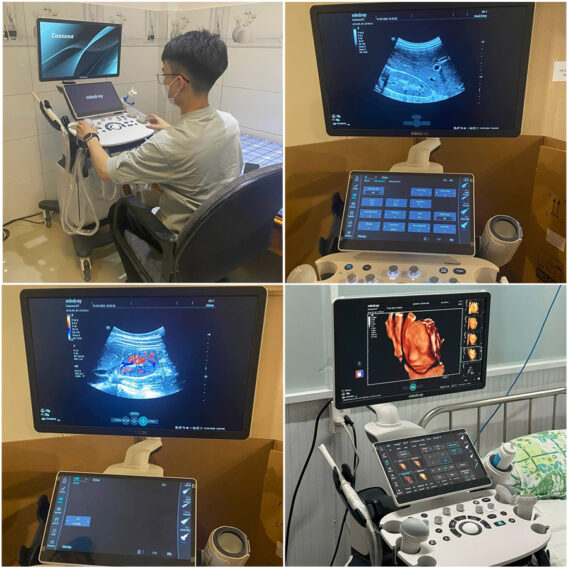 Máy siêu âm bàn đẩy Mindray Consona N7 14 khung anh giao may n7