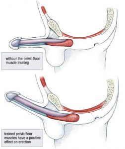 loi-ich-bai-tap-kegel