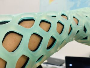 bó bột flexioh flexioh