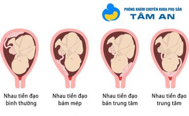 Nhau tiền đạo