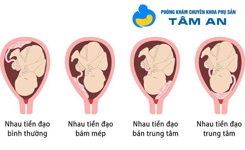 Nhau tiền đạo
