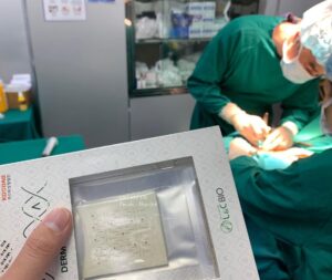 Miếng độn sinh học
