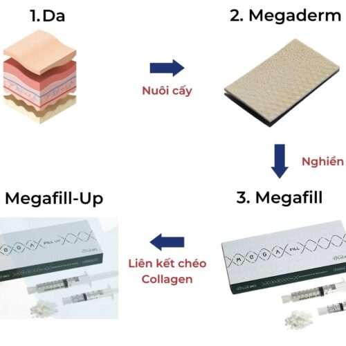 Megafill giá bao nhiêu? Chính sách giá tốt nhất 2026