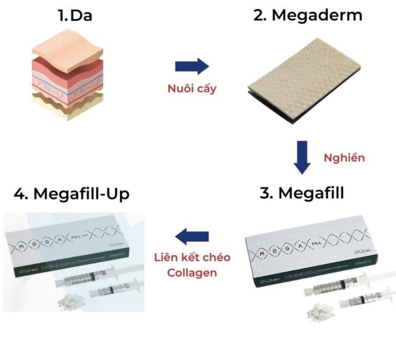 Megafill giá bao nhiêu?
