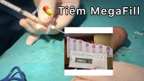 Megafill giá bao nhiêu?