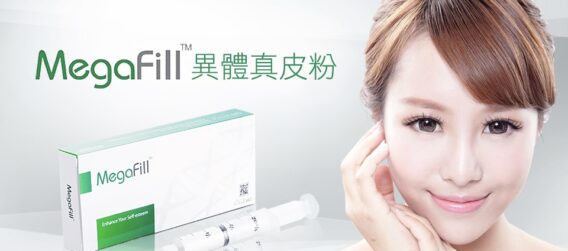 Megafill giá bao nhiêu?
