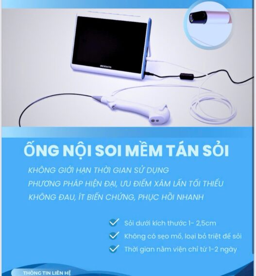 Ống Nội Soi Mềm Tán Sỏi Nội Soi