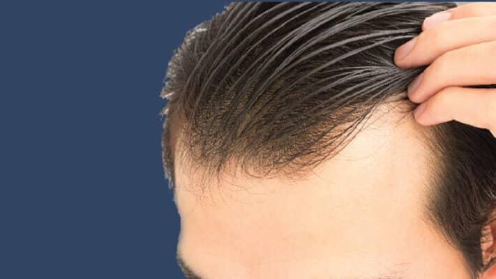 Cách Gội Đầu và Chăm Sóc Tóc Cho Nam Giới: Để Tóc Luôn Khỏe Mạnh và Đẹp" 23 - cach goi dau va cham soc tung loai toc cho nam gioi